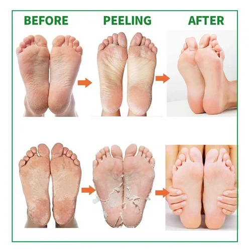 Ultimate 7-Day Deep Exfoliating Foot Mask - Image 2