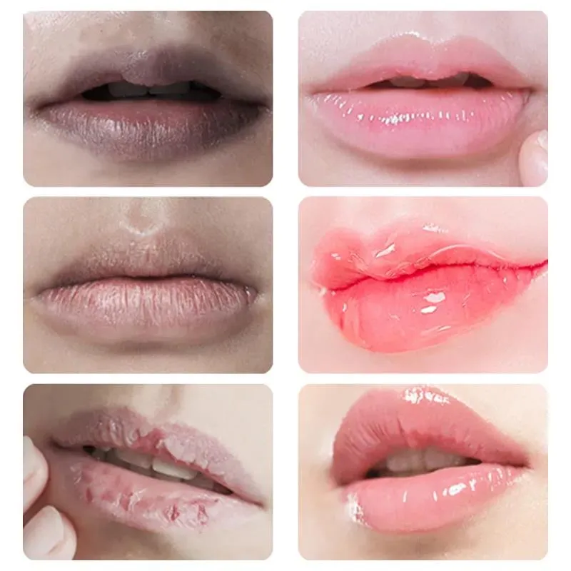 KDK 1# Ultimate Lip Balm - Image 5