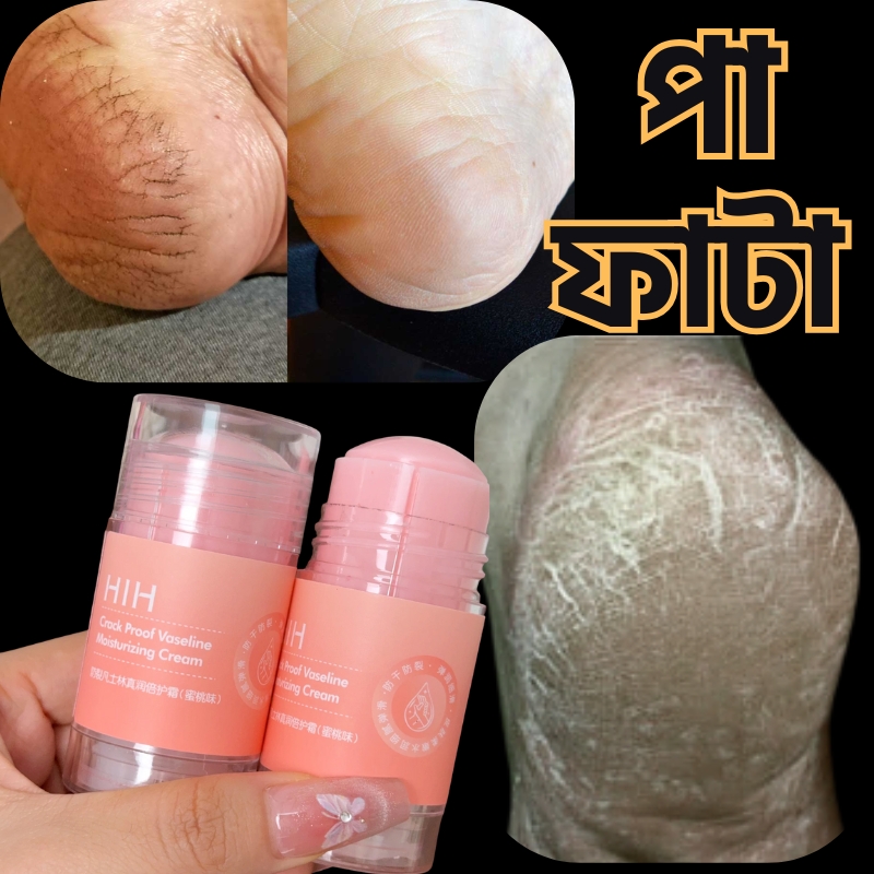 Anti Cracked Summer Vaseline (pink peach)