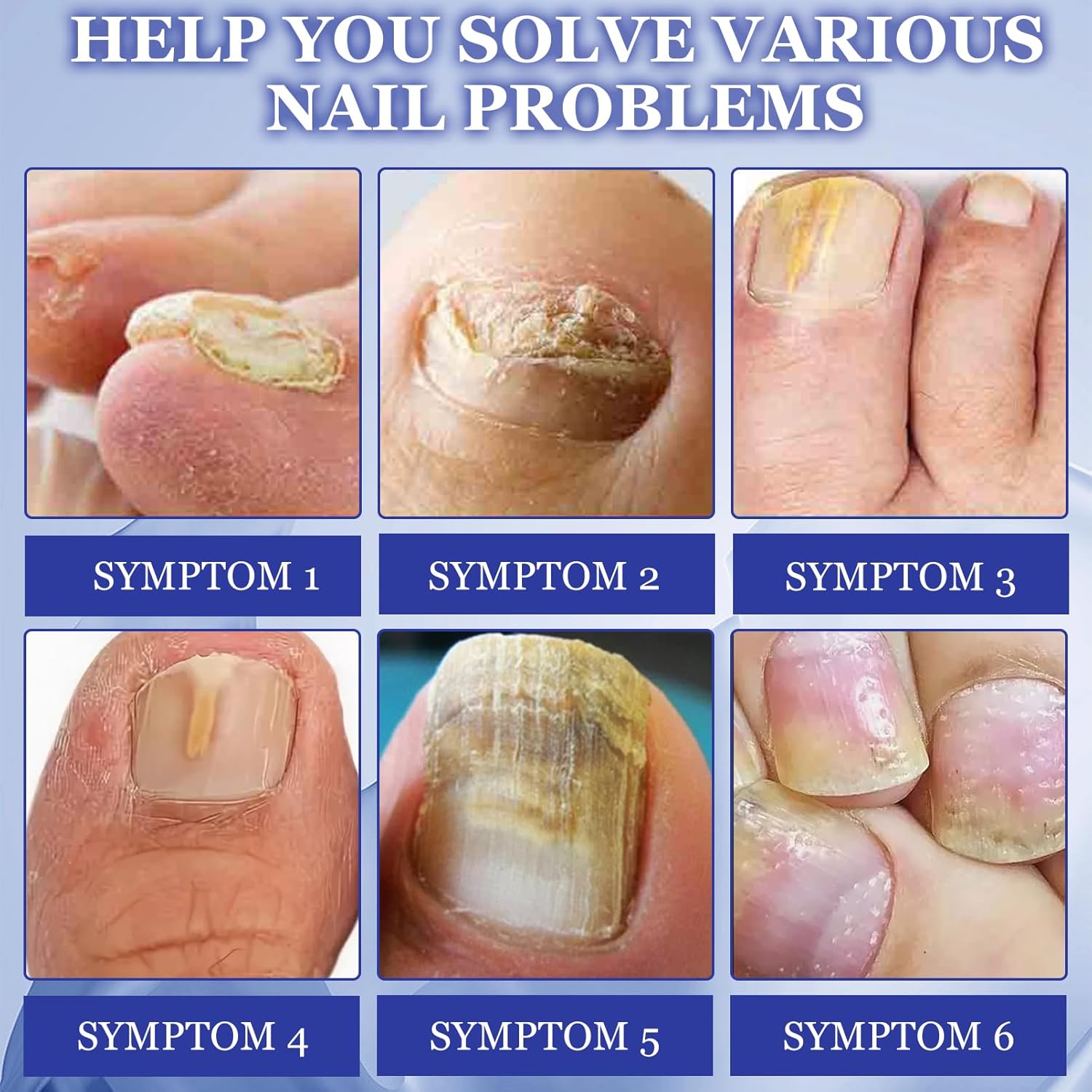 Revive Fungus Nail Patch 10 piece - Image 5