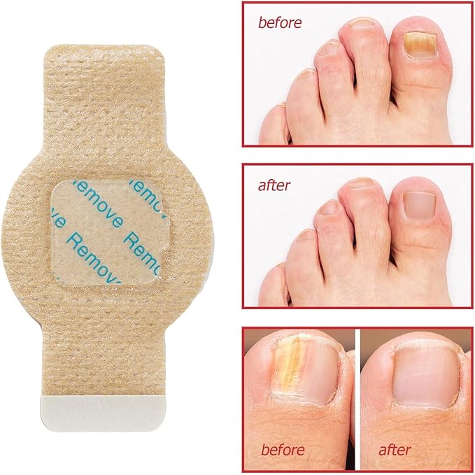 Revive Fungus Nail Patch 10 piece - Image 7